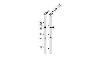 All lanes : Anti-UGT2B4 Antibody (N-term) at 1:8000 dilution Lane 1: human liver lysate Lane 2: MDA-MB-231 whole cell lysate Lysates/proteins at 20 μg per lane.