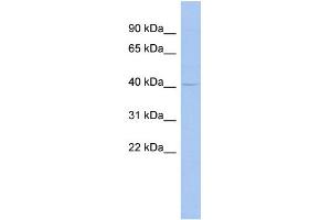 WB Suggested Anti-MSL3L1 Antibody Titration:  0. (MSL3 anticorps  (Middle Region))