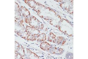 Immunohistochemistry of paraffin-embedded human stomach using  antibody (ABIN6129863, ABIN6136456, ABIN6136457 and ABIN6215371) at dilution of 1:100 (40x lens).