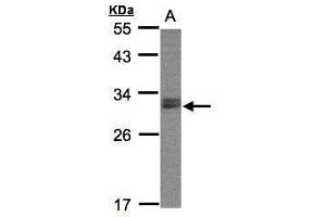 WB Image Sample(30 ug whole cell lysate) A:Raji , 12% SDS PAGE antibody diluted at 1:2000 (NSMCE1 anticorps  (Center))