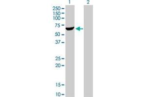 Western Blot analysis of AKT1 expression in transfected 293T cell line by AKT1 monoclonal antibody (M01), clone 4C3.