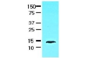 Western Blotting (WB) image for anti-Fatty Acid Binding Protein 1, Liver (FABP1) (AA 1-127), (N-Term) antibody (ABIN317518)