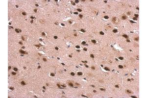 IHC-P Image DDX1 antibody [N3C2], Internal detects DDX1 protein at nucleus on rat fore brain by immunohistochemical analysis.