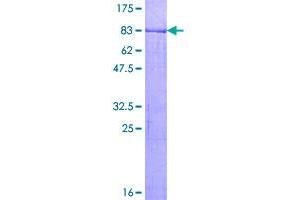 Image no. 1 for Makorin Ring Finger Protein 1 (MKRN1) (AA 1-482) protein (GST tag) (ABIN1310982)