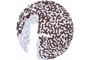 Strong Hepatocyte staining in hepatocytes while other structures of the liver remain negative (Hepatocyte Specific Antigen anticorps)