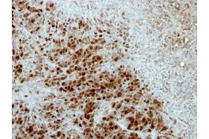IHC-P Image Immunohistochemical analysis of paraffin-embedded SCM1 xenograft, using ARSA, antibody at 1:500 dilution.