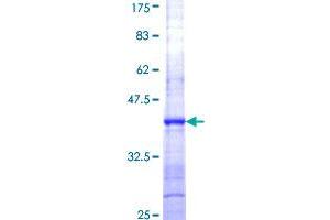 RPL27A Protein (AA 49-148) (GST tag)