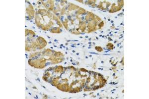Immunohistochemistry of paraffin-embedded human stomach using PLA2G2D antibody (ABIN5974036) at dilution of 1/100 (40x lens). (PLA2G2D anticorps)
