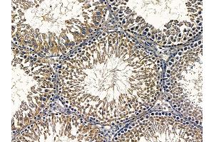 ABIN6257042 and ABIN6275505 at 1/100 staining rat testis tissue by IHC-P. (RIMKLA anticorps  (Internal Region))