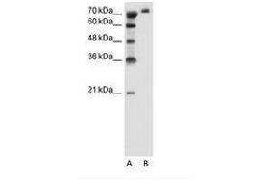 Image no. 2 for anti-Solute Carrier Family 6, Member 18 (SLC6A18) (AA 351-400) antibody (ABIN205030) (SLC6A18 anticorps  (AA 351-400))