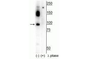 Western blot of human T47D cell lysate showing specific immunolabeling of the ~100 kDa CtIP phosphorylated at Ser326 in the first lane (-). (Retinoblastoma Binding Protein 8 anticorps  (pSer326))