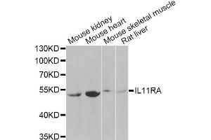 Western blot analysis of extracts of various cell lines, using IL11RA Antibody (ABIN2563389) at 1:1000 dilution. (IL11RA anticorps)
