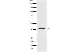 Western blot analysis of macroH2A.