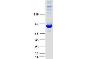 Inosine 5'-Phosphate Dehydrogenase 1 (IMPDH1) (Transcript Variant 2) protein (Myc-DYKDDDDK Tag)