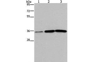 Western Blot analysis of Human testis tissue, A549 and PC3 cell using MAGEA3 Polyclonal Antibody at dilution of 1:400 (MAGEA3 anticorps)