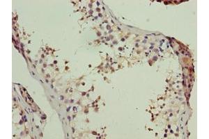 Immunohistochemistry of paraffin-embedded human testis tissue using ABIN7174200 at dilution of 1:100