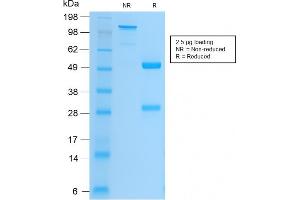 SDS-PAGE Analysis Purified CD61 Rabbit Recombinant Monoclonal Antibody (ITGB3/2166R).