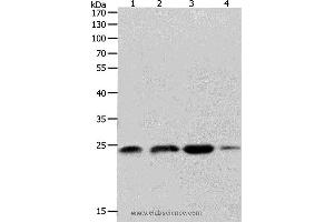 Western blot analysis of K562, 231 and Hela cell, Human fetal brain tissue, using RHOA Polyclonal Antibody at dilution of 1:400 (RHOA anticorps)