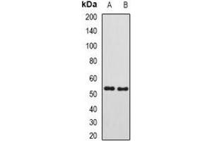 Western blot analysis of SUFU expression in mouse testis (A), rat kidney (B) whole cell lysates. (SUFUH anticorps)