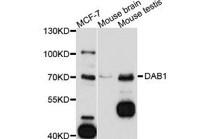 Western blot analysis of extracts of various cell lines, using DAB1 antibody (ABIN5997560) at 1/1000 dilution. (DAB1 anticorps)
