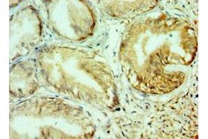 Immunohistochemistry of paraffin-embedded human prostate tissue using ABIN7148222 at dilution of 1:100 (COL1A1 anticorps  (AA 521-680))