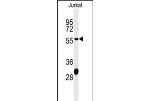 Western blot analysis of HADHB Antibody (C-term) (ABIN653816 and ABIN2843089) in Jurkat cell line lysates (35 μg/lane). (HADHB anticorps  (C-Term))