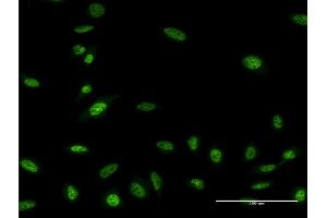Immunofluorescence of monoclonal antibody to OLIG2 on HeLa cell. (OLIG2 anticorps  (AA 2-78))