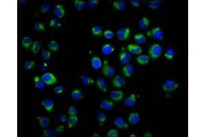Immunofluorescence staining of Hela cells with ABIN7167342 at 1:166, counter-stained with DAPI. (RAB42 anticorps  (AA 1-105))