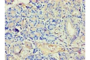 Immunohistochemistry of paraffin-embedded human pancreatic tissue using ABIN7144294 at dilution of 1:100 (Annexin VII anticorps  (AA 259-488))