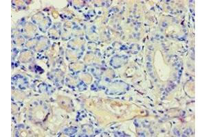 Immunohistochemistry of paraffin-embedded human pancreatic tissue using ABIN7144294 at dilution of 1:100