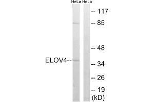 Western blot analysis of extracts from HeLa cells, using ELOVL4 antibody. (ELOVL4 anticorps  (Internal Region))