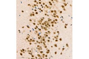 Immunohistochemistry of paraffin embedded mouse brain using COPS2 (ABIN7073324) at dilution of 1:1400 (400x lens) (CSN2 anticorps)