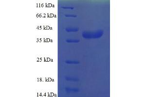 SDS-PAGE (SDS) image for Mitochondrial Ribosomal Protein L55 (MRPL55) (AA 34-128) protein (GST tag) (ABIN5709967)