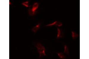 ABIN6275884 staining COLO205 by IF/ICC. (CSF2RA anticorps  (Internal Region))