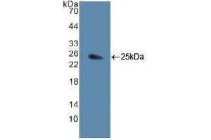 WB of Protein Standard: different control antibodies  against Highly purified E.