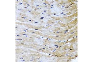 Immunohistochemistry of paraffin-embedded mouse heart using M6PR antibody (ABIN5975018) at dilution of 1/100 (40x lens). (M6PR anticorps)