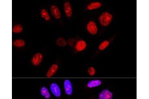 Confocal immunofluorescence analysis of U-2 OS cells using Ataxin 3 Polyclonal Antibody at dilution of 1:100. (Ataxin 3 anticorps)