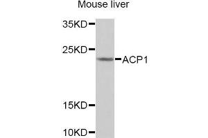 Western blot analysis of extracts of Mouse liver cells, using ACP1 antibody.