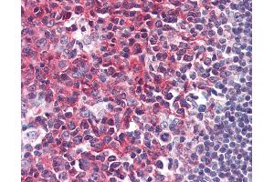 Anti-PAG1 / PAG antibody IHC of human tonsil.