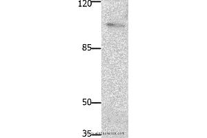 Western blot analysis of Mouse brain tissue, using PTK2 Polyclonal Antibody at dilution of 1:1850 (FAK anticorps)