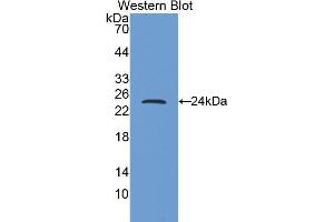 Western Blotting (WB) image for anti-Myosin Heavy Chain 6, Cardiac Muscle, alpha (MYH6) (AA 1747-1938) antibody (ABIN1859930)