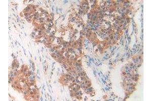 Figure. (PDXK anticorps  (AA 29-253))