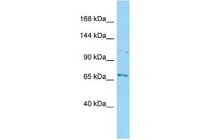 Host: Rabbit Target Name: SEC31B Sample Type: HepG2 Whole Cell lysates Antibody Dilution: 1. (SEC31B anticorps  (Middle Region))