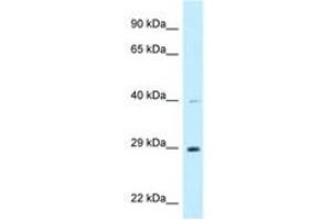 anti-DnaJ (Hsp40) Homolog, Subfamily C, Member 9 (DNAJC9) (AA 182-231) antibody