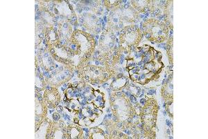 Immunohistochemistry of paraffin-embedded rat kidney using  Antibody (ABIN6127328, ABIN6136696, ABIN6136697 and ABIN6217467) at dilution of 1:100 (40x lens). (Adenylate Kinase 1 anticorps  (AA 1-194))