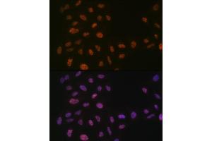 Immunofluorescence analysis of U-2 OS cells using PRPF8 Rabbit mAb (ABIN7269737) at dilution of 1:100 (40x lens).