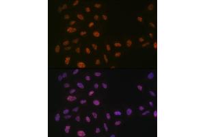 Immunofluorescence analysis of U-2 OS cells using PRPF8 Rabbit mAb (ABIN7269737) at dilution of 1:100 (40x lens). (PRPF8 anticorps)