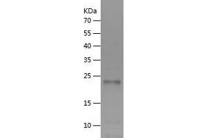 Interleukin 6 (IL6) (AA 23-210) protein (His tag)