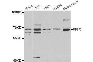 Western Blotting (WB) image for anti-Polymeric Immunoglobulin Receptor (PIGR) antibody (ABIN1877116) (PIGR anticorps)