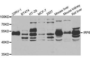 Western Blotting (WB) image for anti-Interferon Regulatory Factor 6 (IRF6) antibody (ABIN1882373) (IRF6 anticorps)